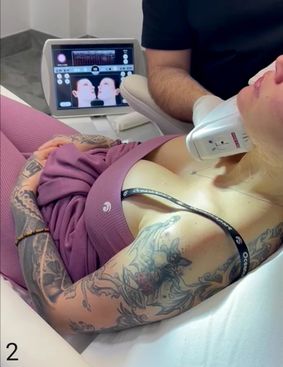 DR. Dimas - Hautstraffung mit HIFU